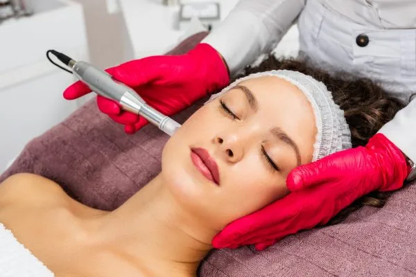 Microneedling Microneedling