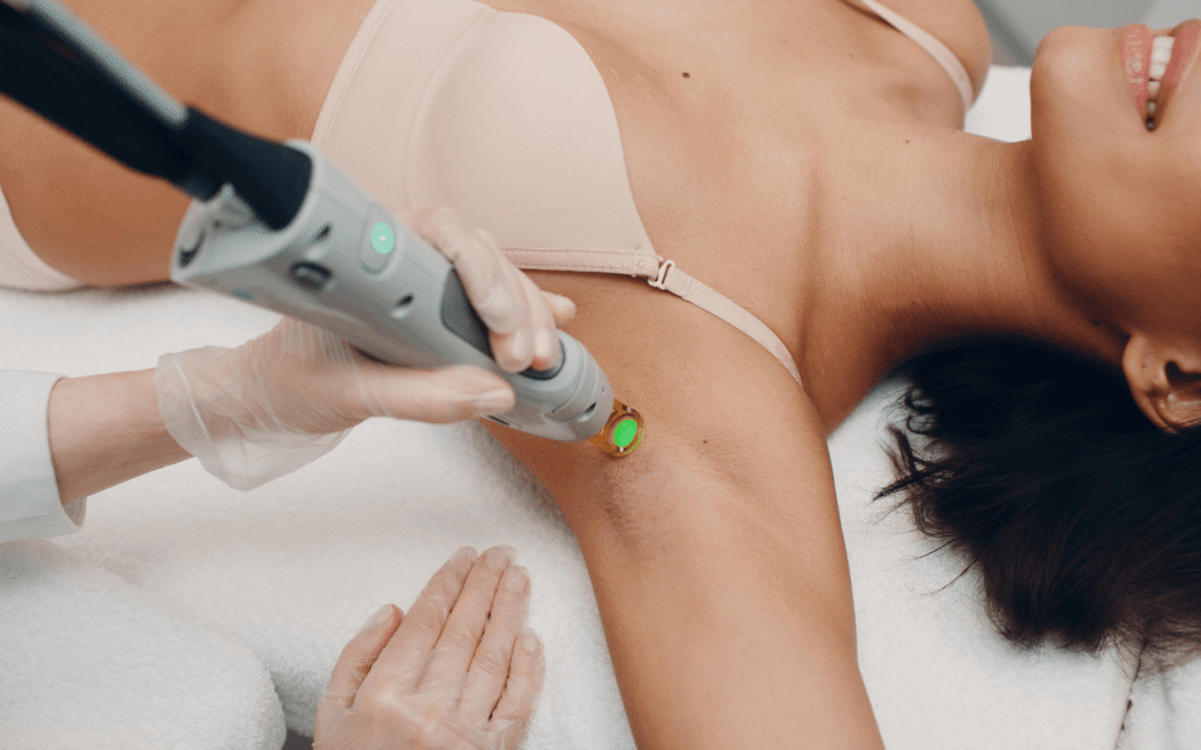 Laser Hair Removal: The Ultimate Guide to Silky Smooth Skin!