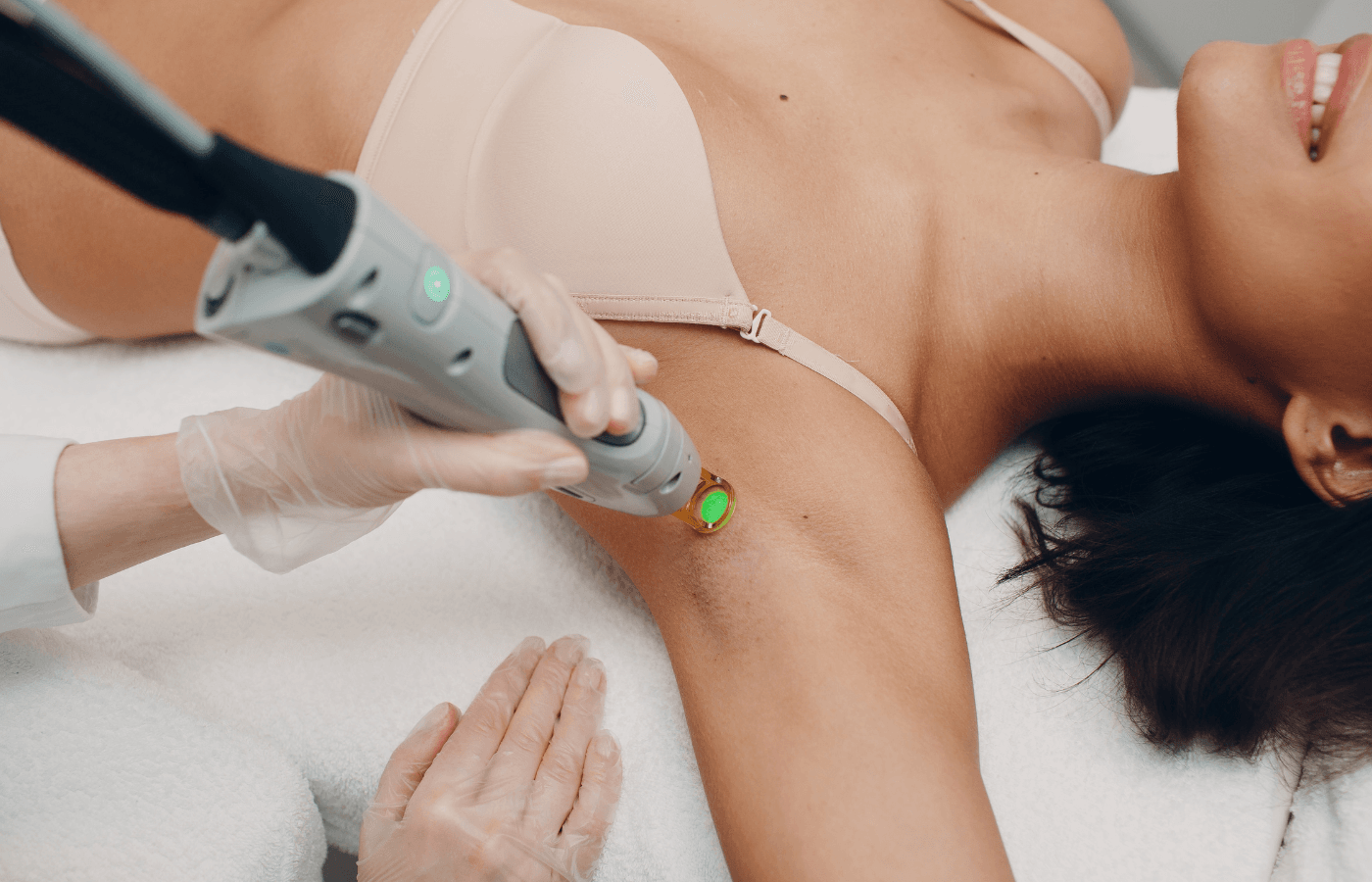 laser hair removal