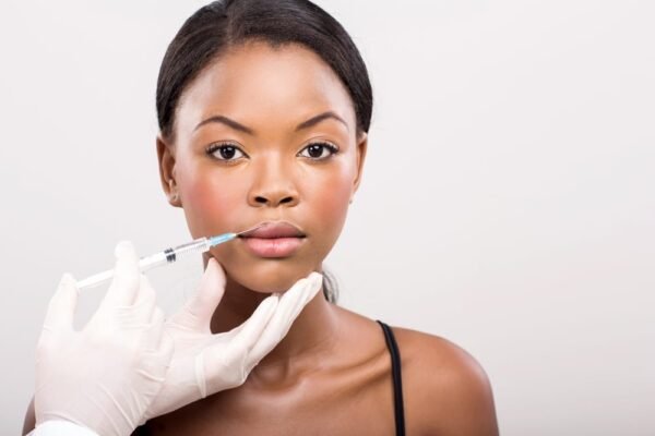 Lip Filler