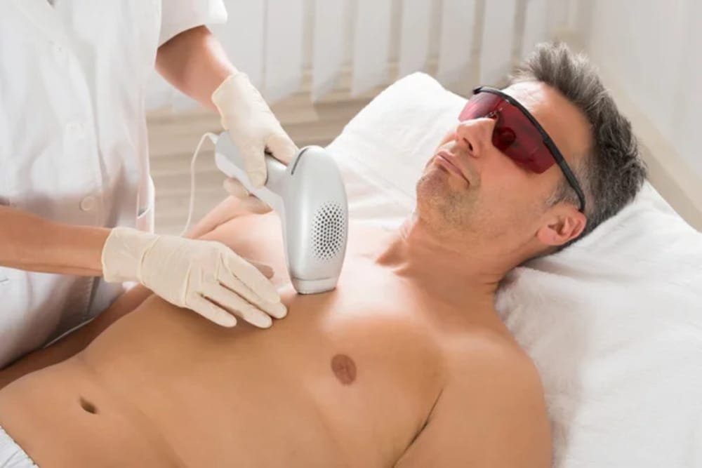 Laser Hair Removal Small 1 Laser Hair Removal Small 1