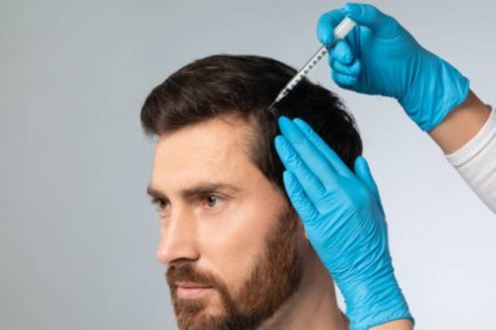 Microneedling for Hair Restoration Small 2 Microneedling for Hair Restoration Small 2