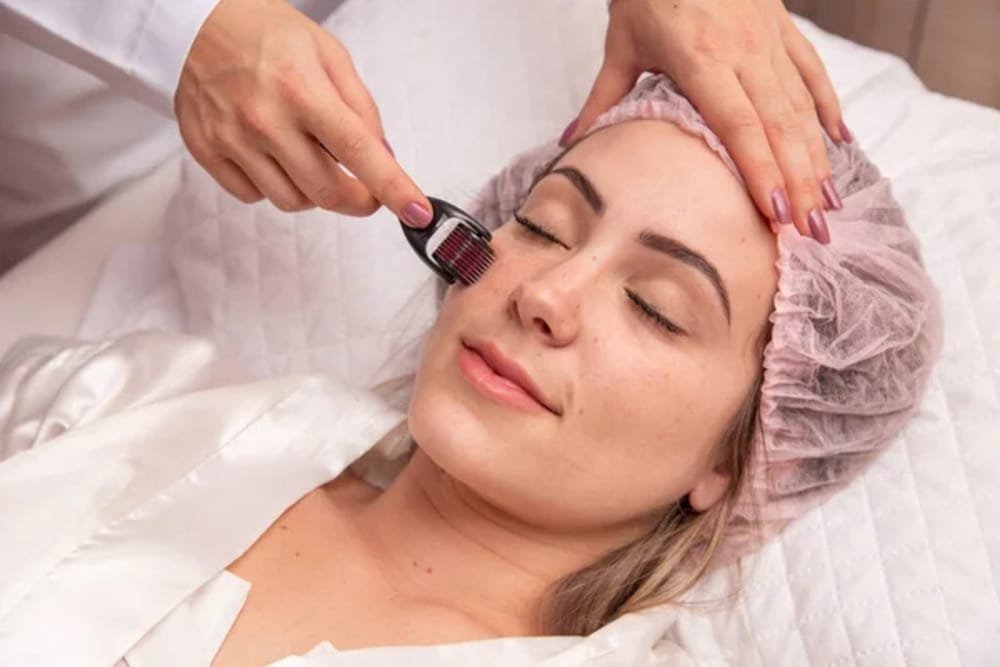 Traditional Microneedling Small.1jpg Traditional Microneedling Small.1jpg