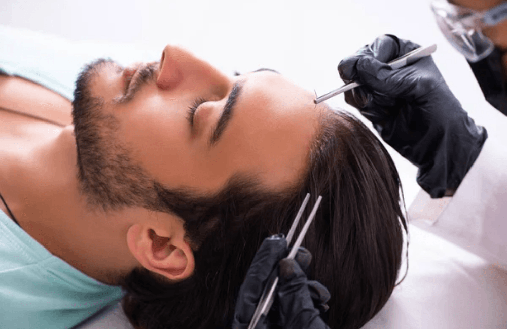 Hair Restoration (3) Hair Restoration 3