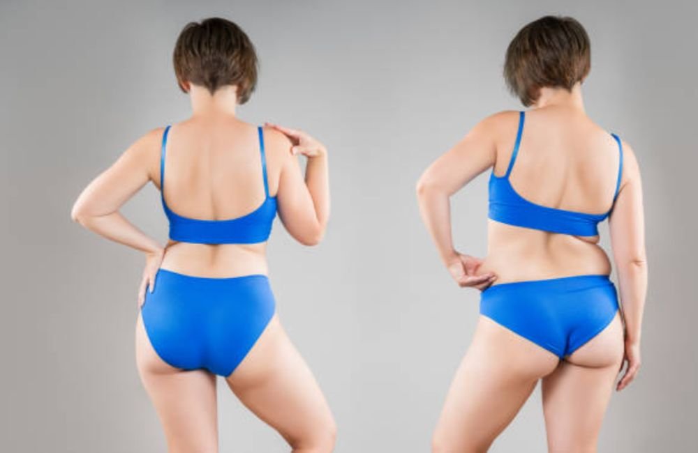 Body Contouring & Sculpting before and after