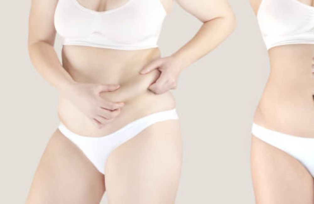 Body Contouring In Mesa, AZ