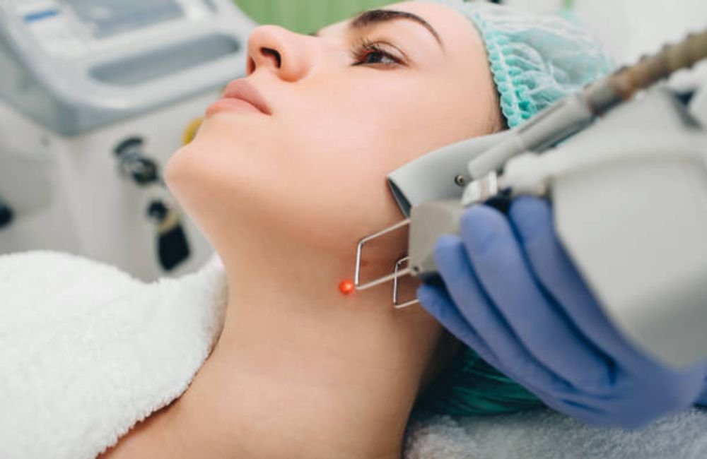 Laser Treatments In Mesa, AZ