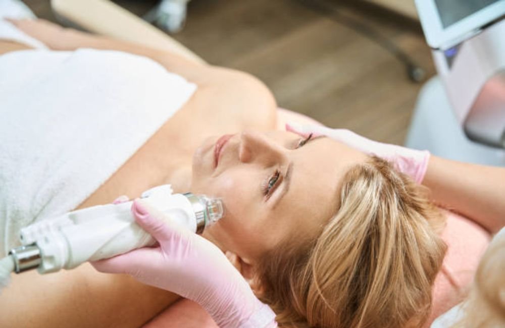 RF Microneedling In Mesa, AZ