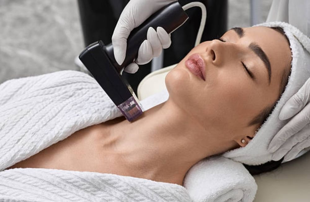 RF Microneedling In Mesa, AZ