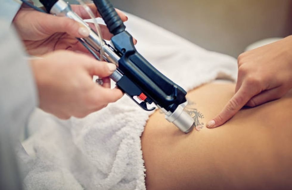 Laser Tattoo Removal Phoenix Mesa Laser Tattoo Removal Phoenix Mesa