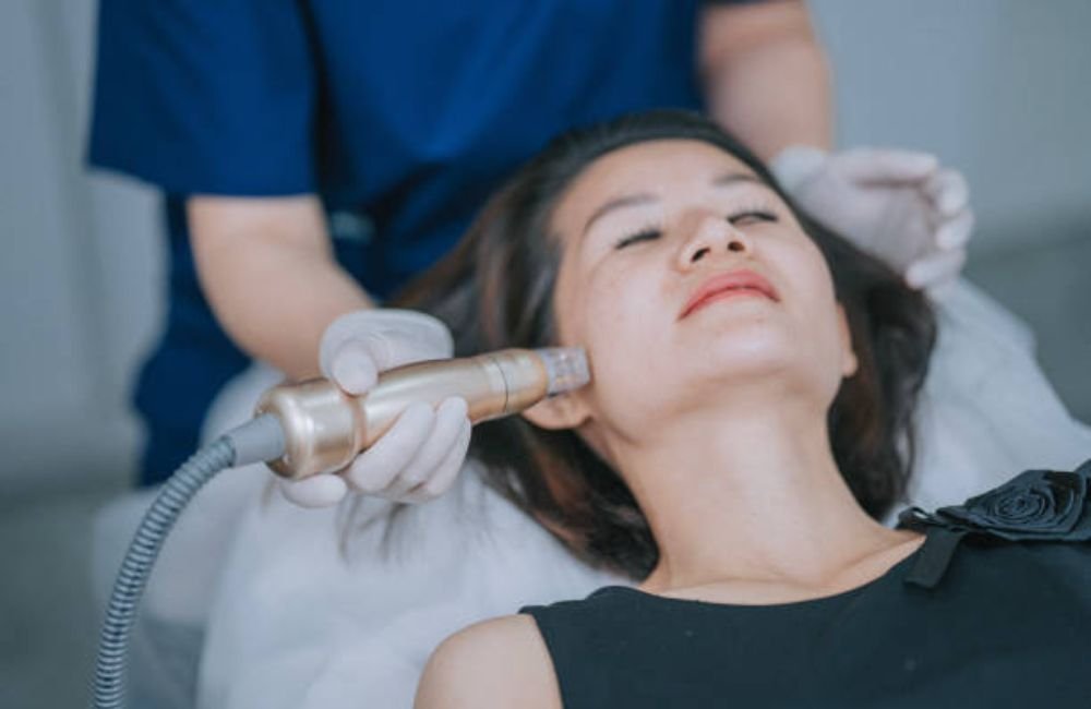 Exact RF Microneedling In East Valley, AZ