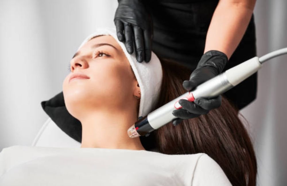 Exact RF Microneedling In East Valley, AZ