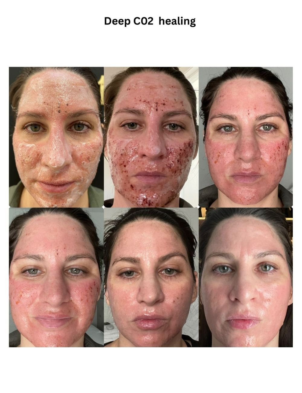 Body Contouring & Sculpting before and after