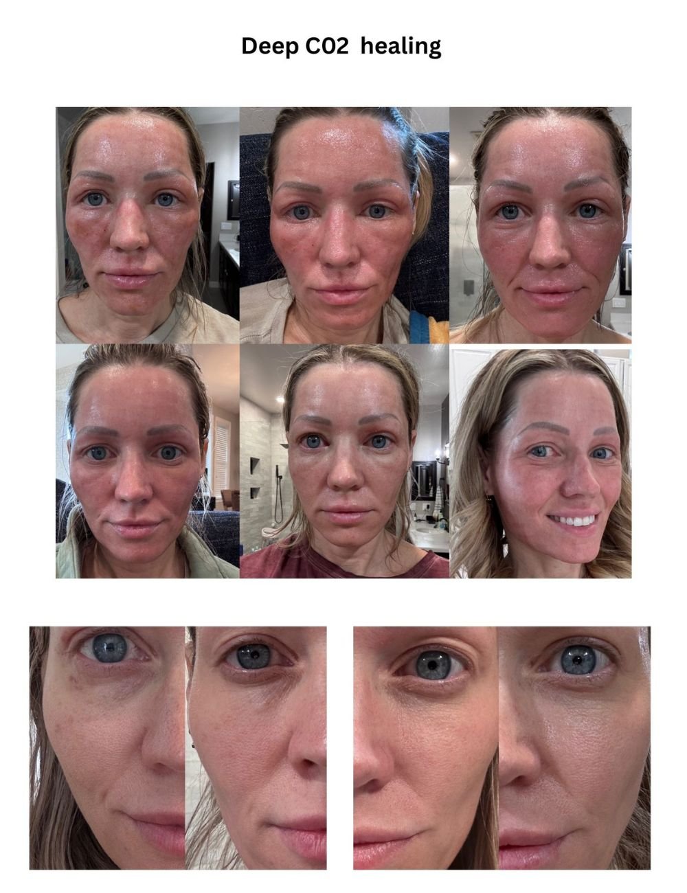 Body Contouring & Sculpting before and after