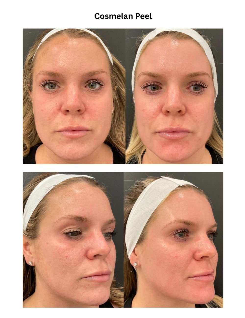 Body Contouring & Sculpting before and after