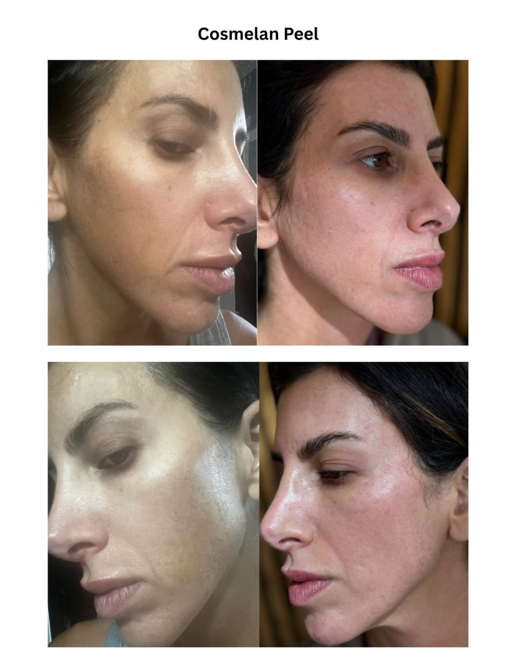 Body Contouring & Sculpting before and after