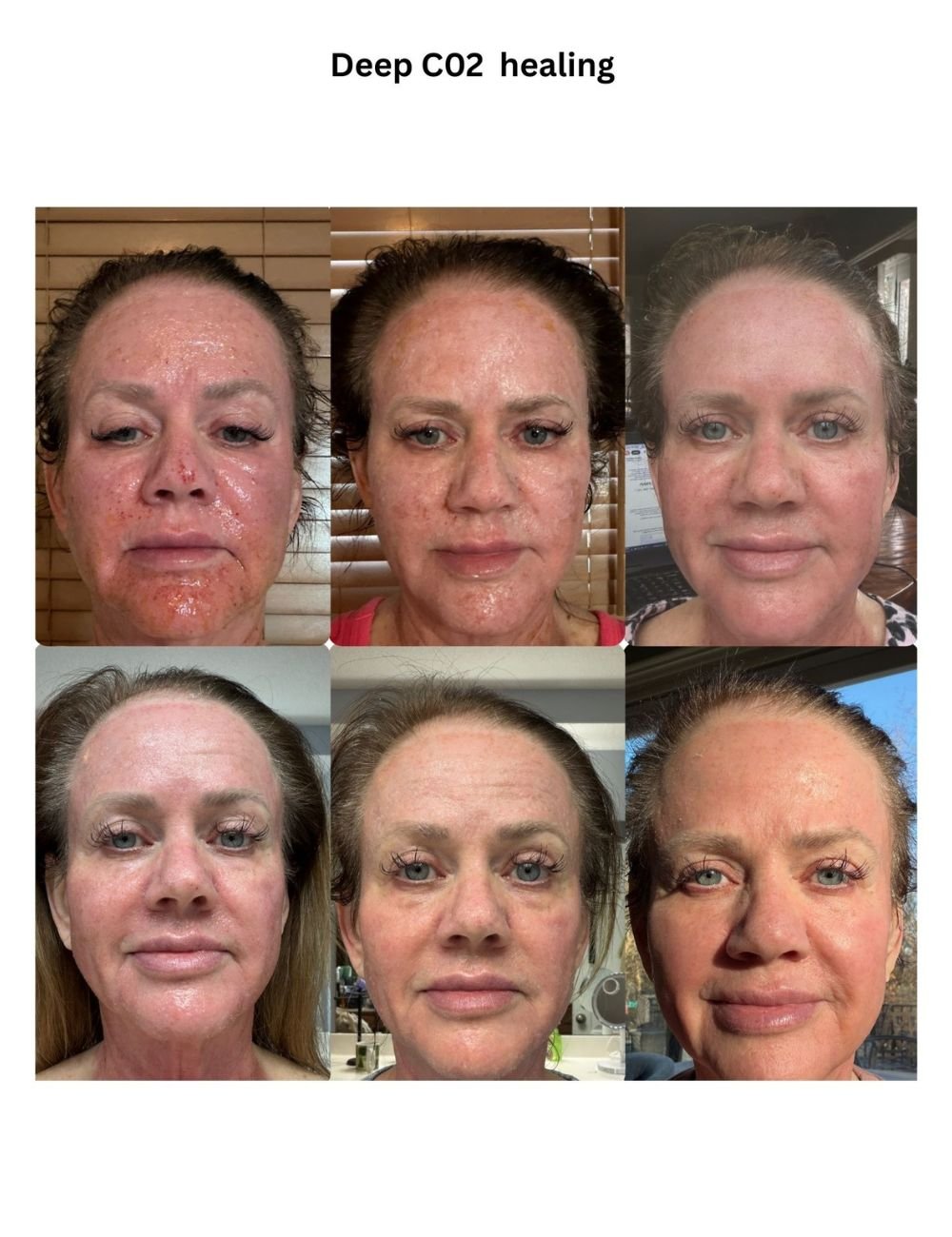 Body Contouring & Sculpting before and after