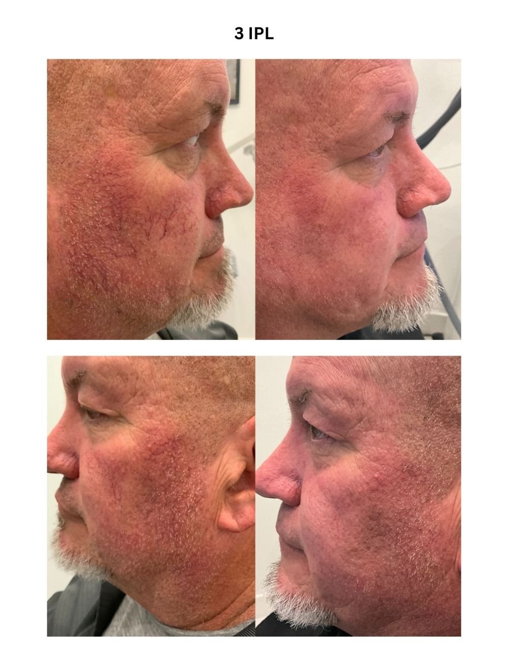 Body Contouring & Sculpting before and after