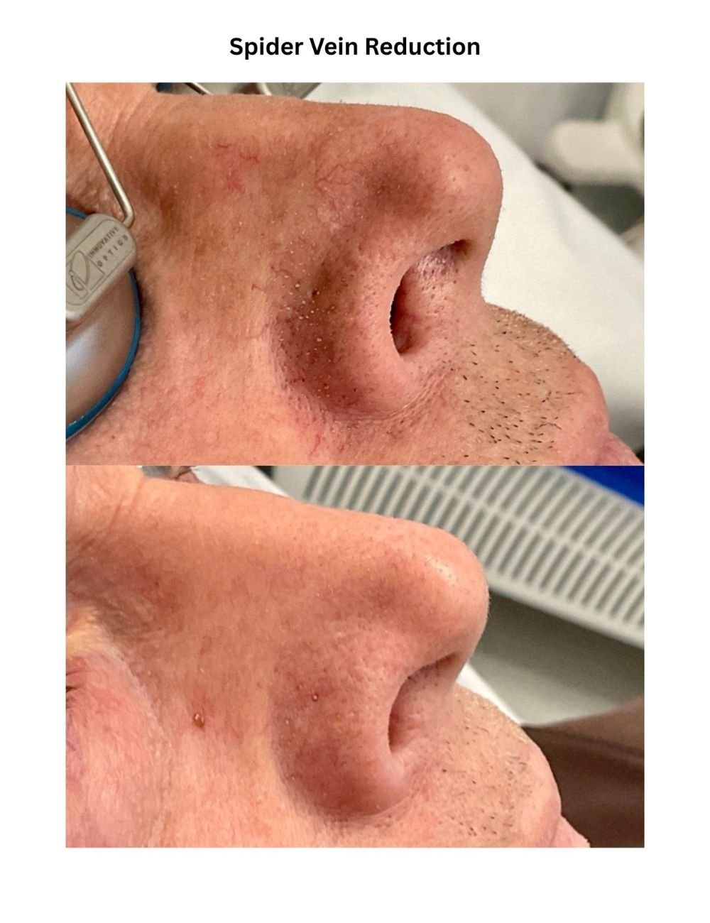 Body Contouring & Sculpting before and after