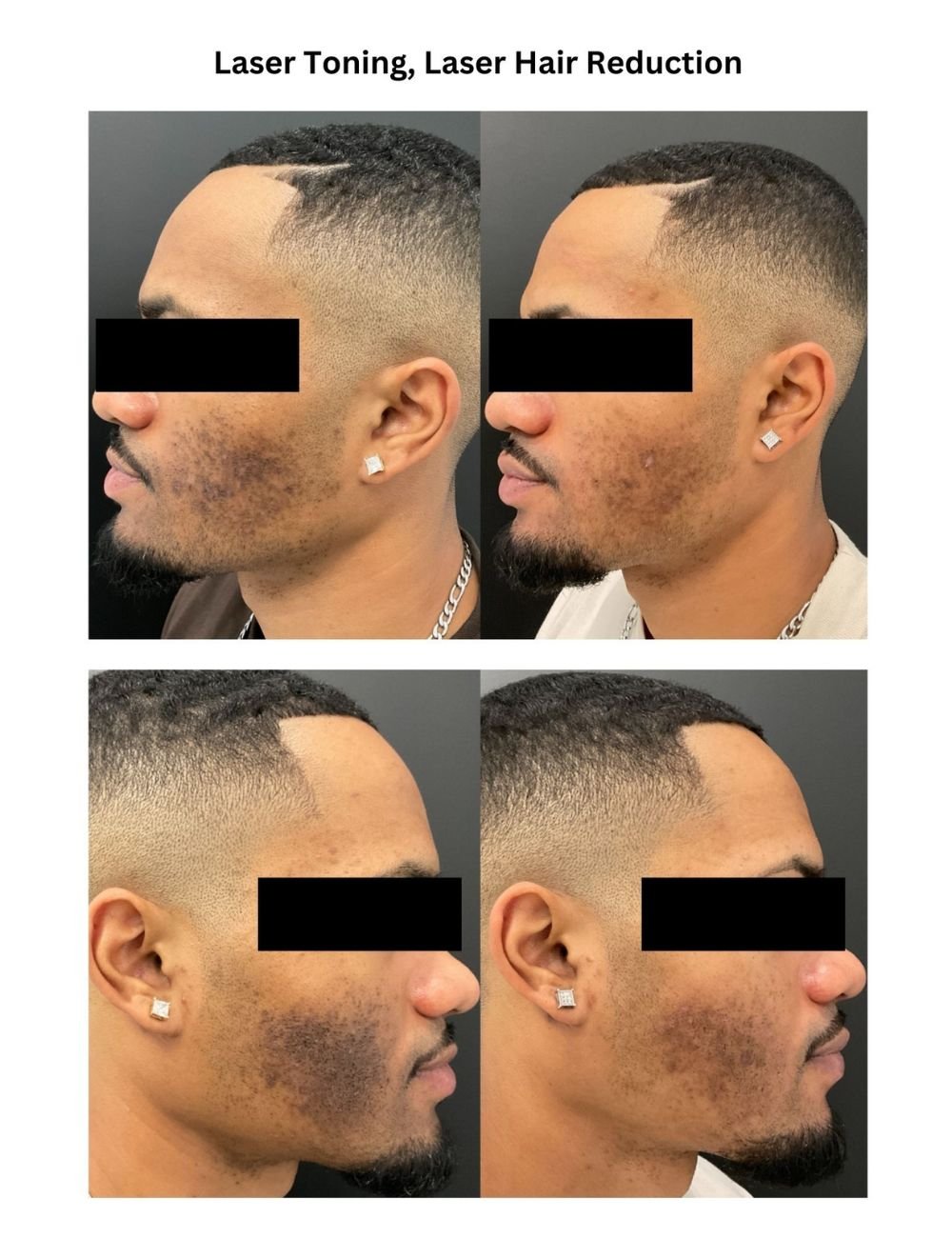 Body Contouring & Sculpting before and after