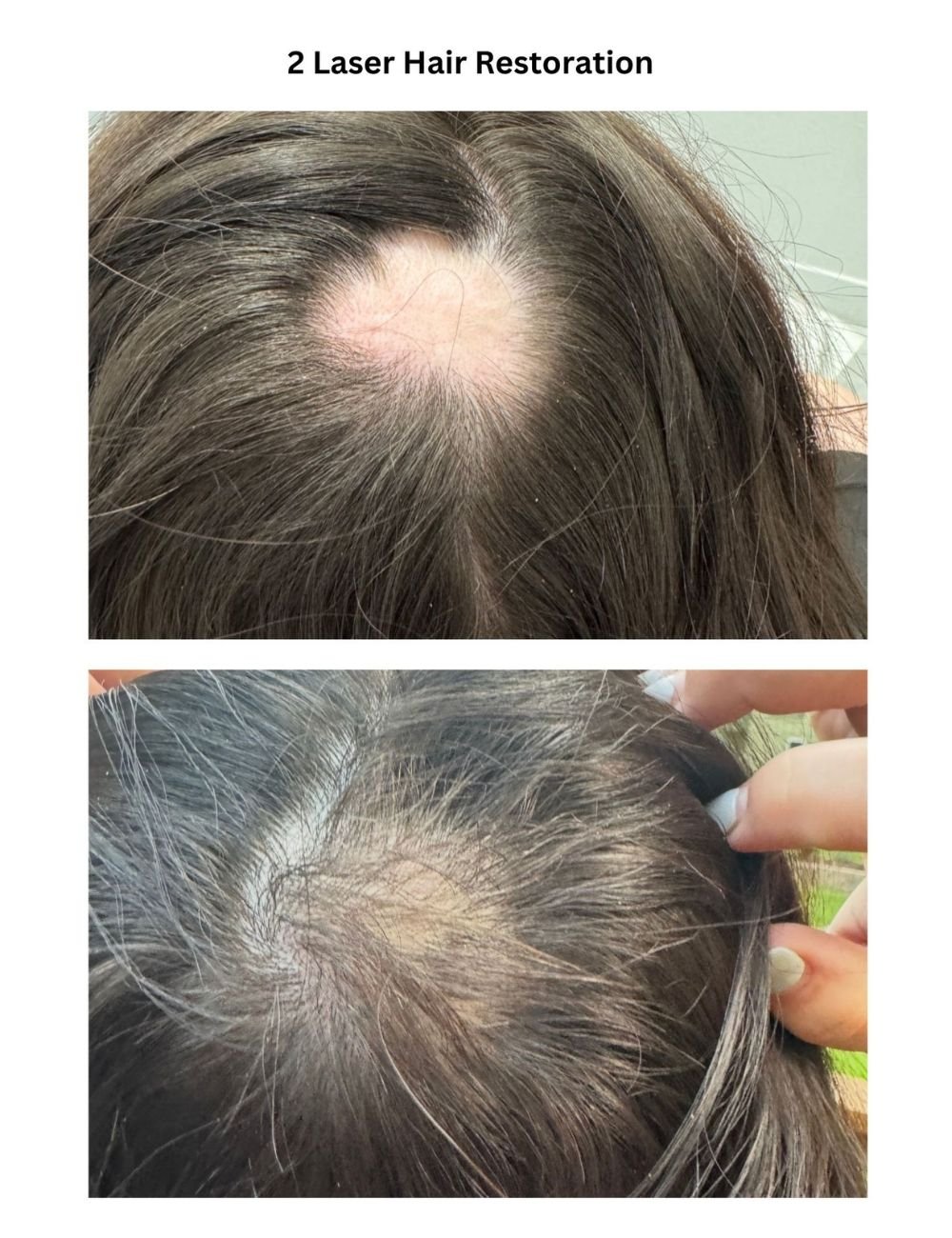 Body Contouring & Sculpting before and after