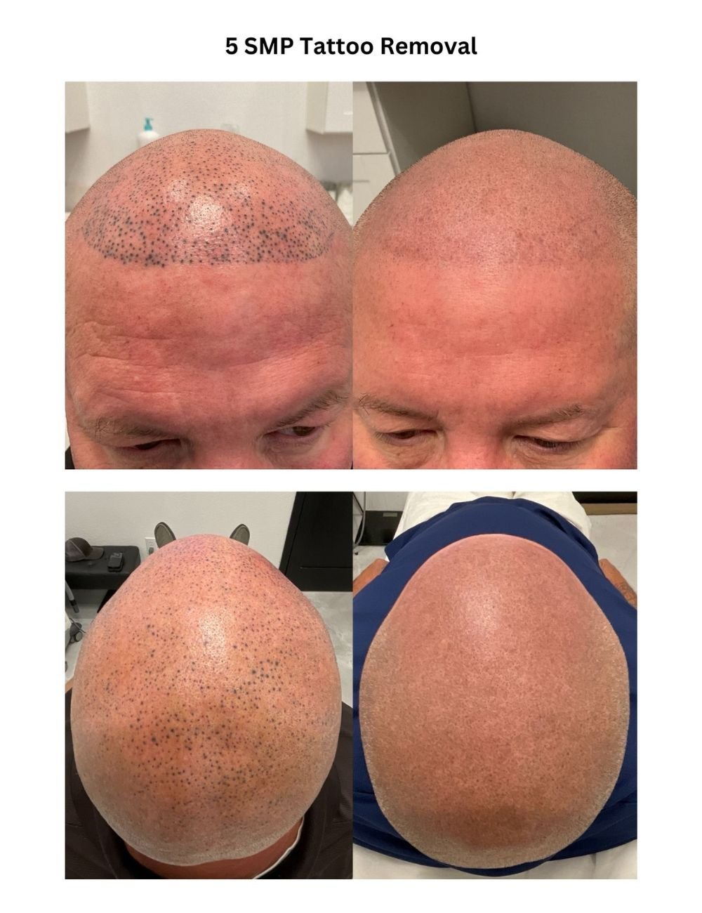 Body Contouring & Sculpting before and after