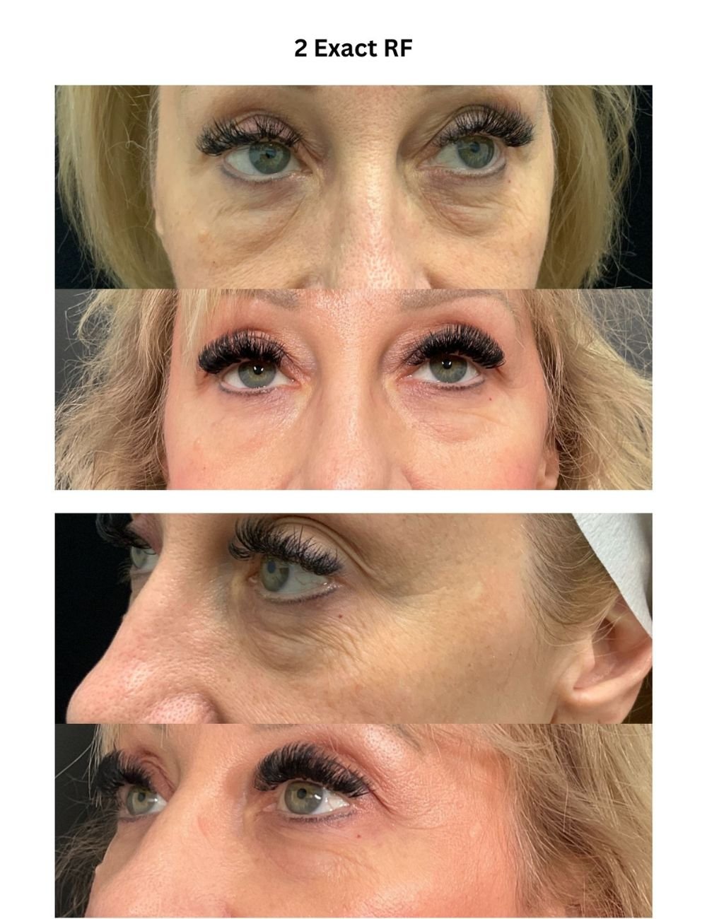 Body Contouring & Sculpting before and after