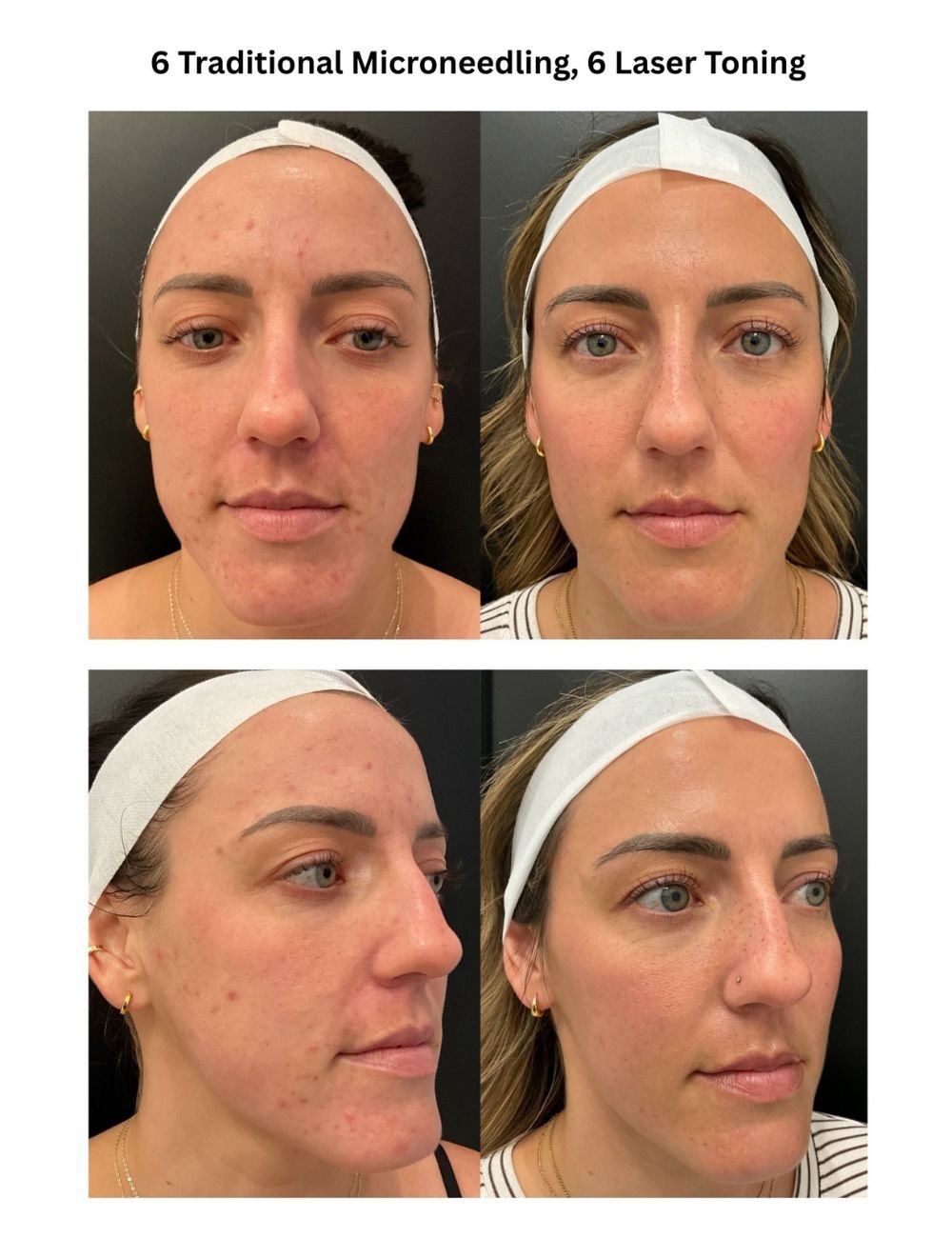 Body Contouring & Sculpting before and after