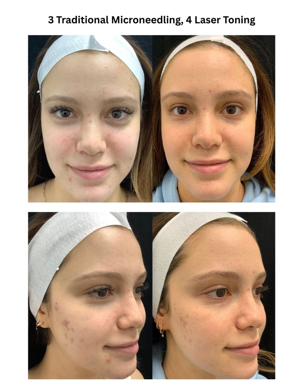 Body Contouring & Sculpting before and after