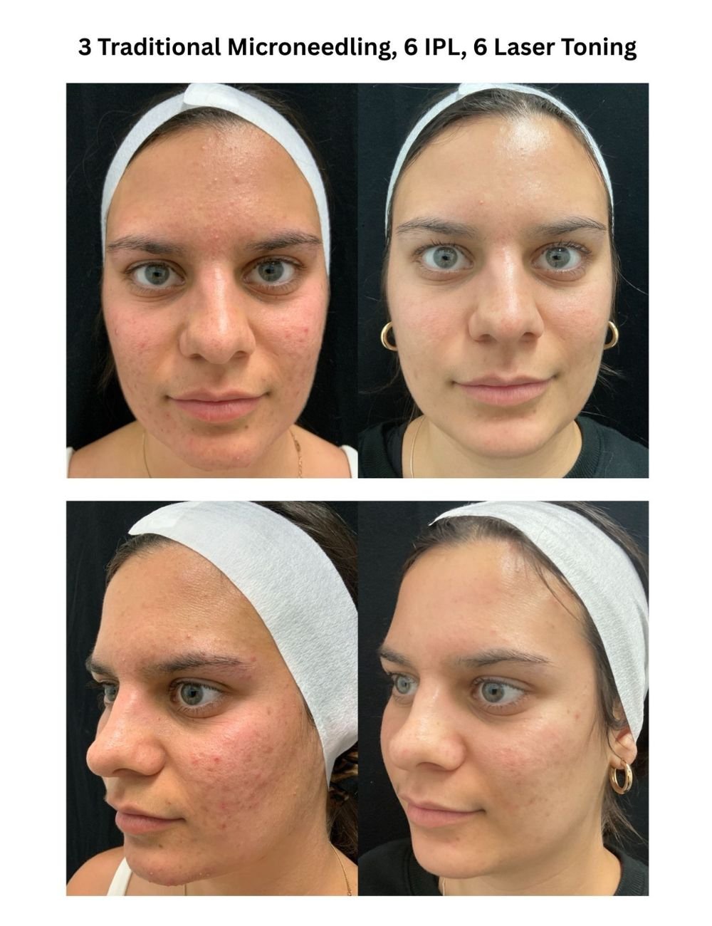 Body Contouring & Sculpting before and after