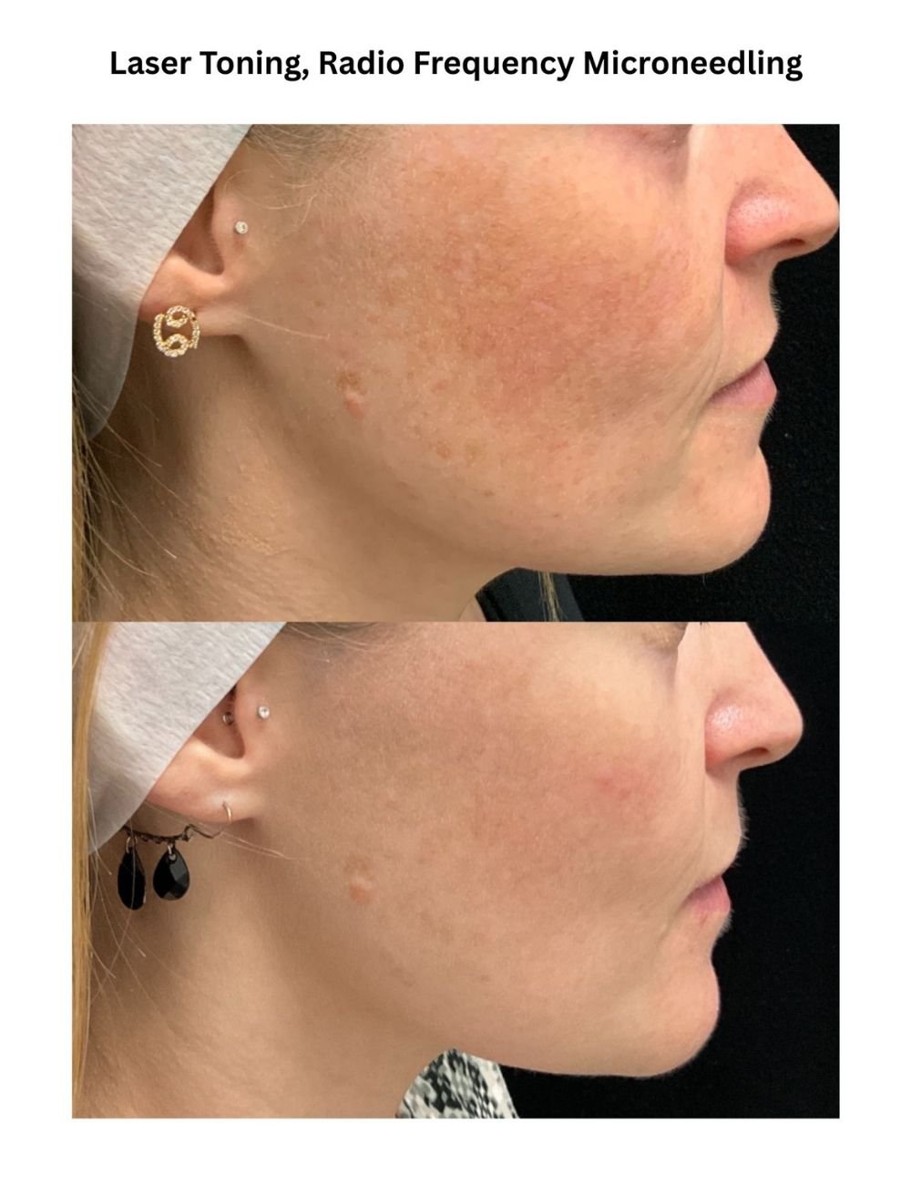 Body Contouring & Sculpting before and after