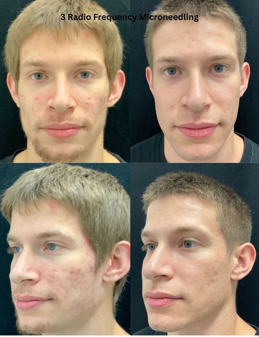 Body Contouring & Sculpting before and after