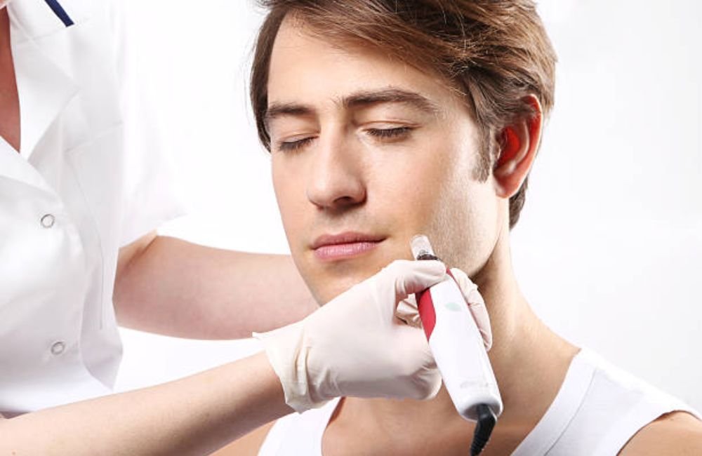 Smart RF Microneedling In East Valley, AZ