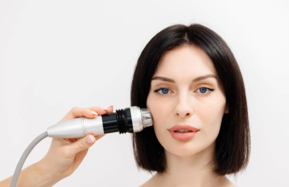 Smart RF Microneedling In East Valley, AZ