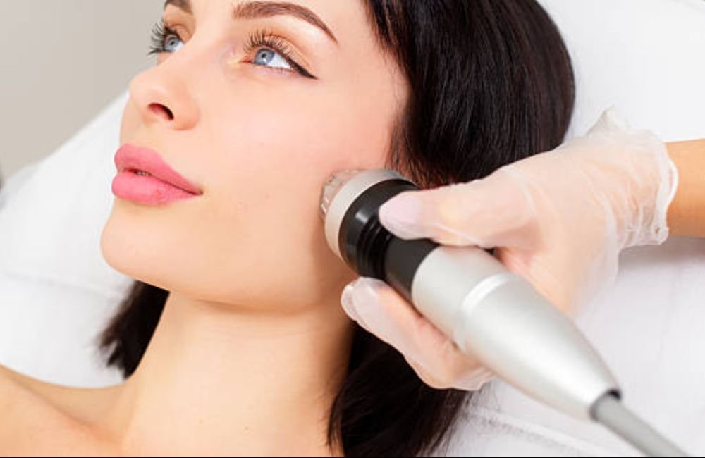 Smart RF Microneedling In East Valley, AZ