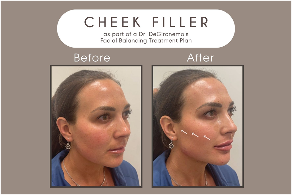 Body Contouring In Mesa, AZ