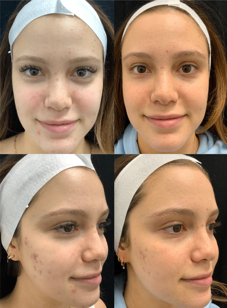 Body Contouring & Sculpting before and after