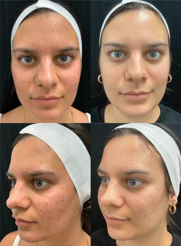 Body Contouring & Sculpting before and after