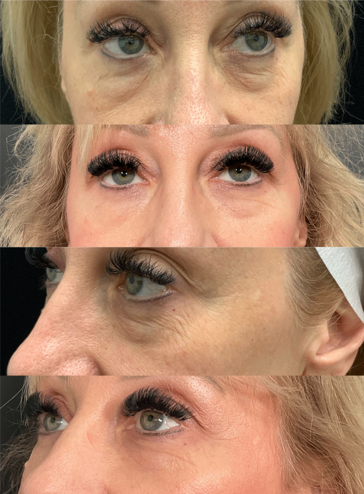 Body Contouring & Sculpting before and after