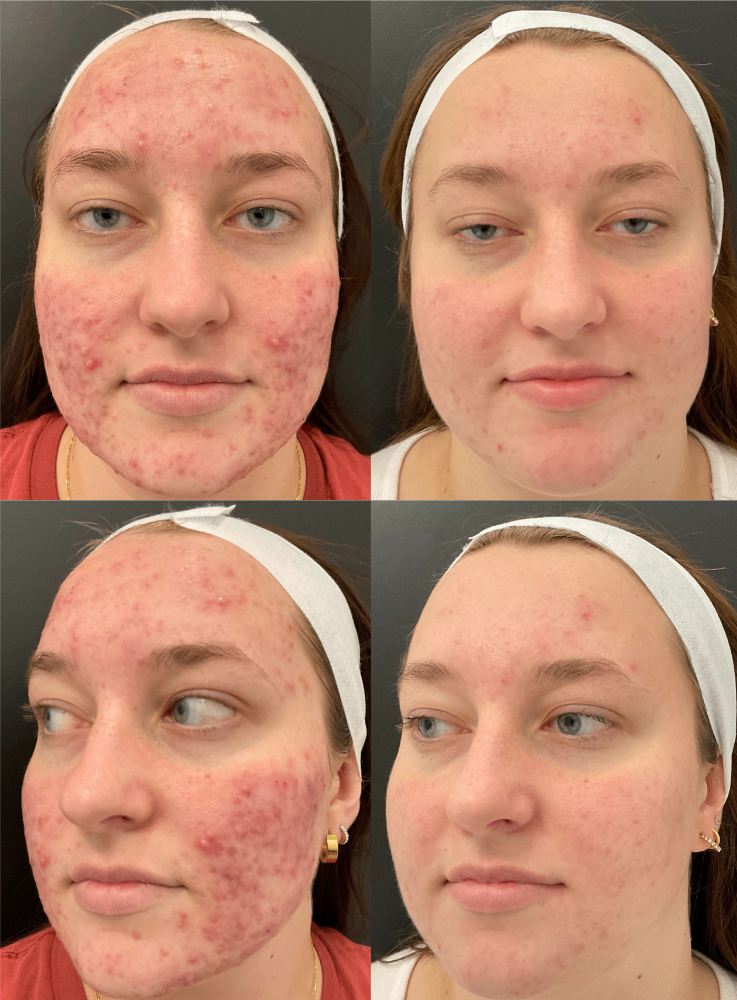 Body Contouring & Sculpting before and after